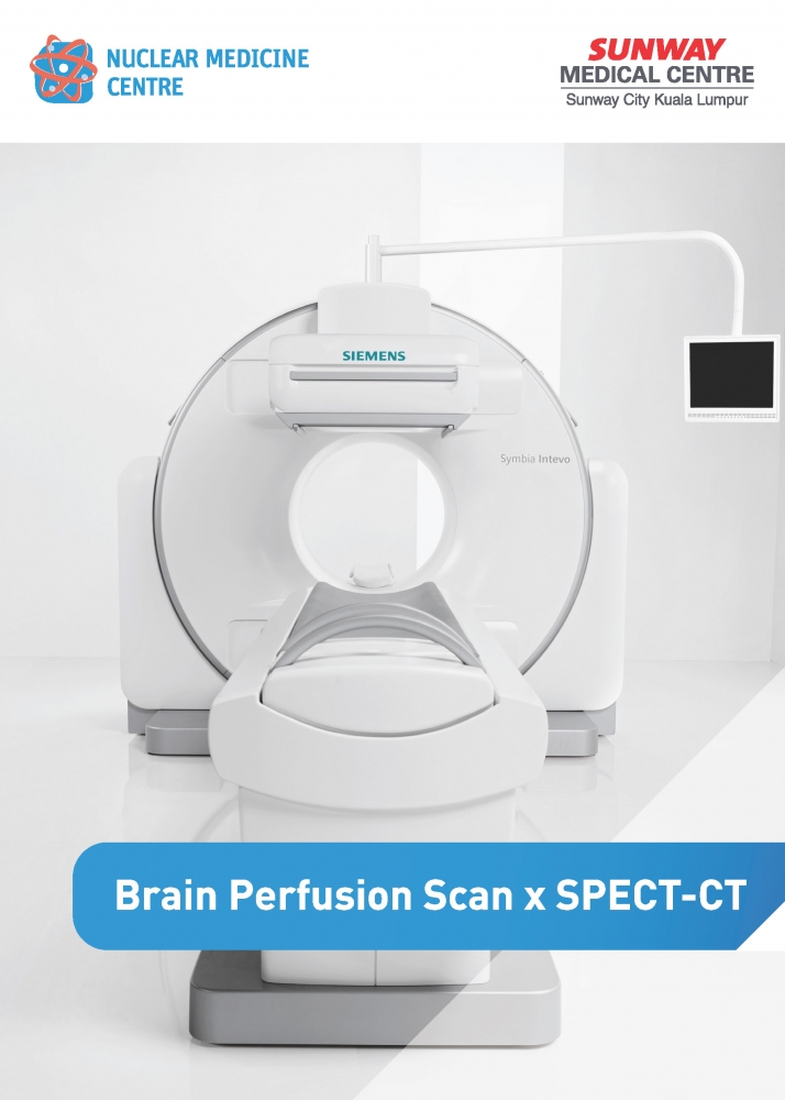 脑灌注扫描 x SPECT-CT