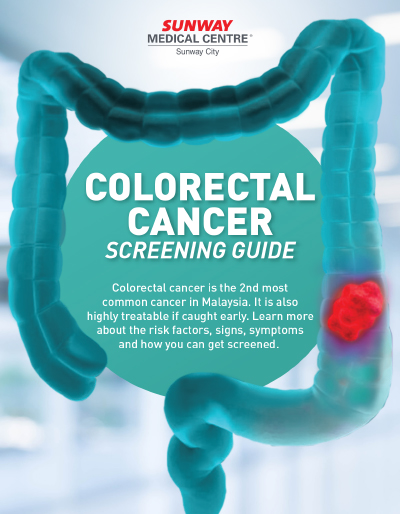 Colorectal Cancer Screening Guide