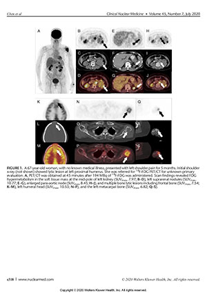 Ga-PSMA PET/CT 和 F-FDG PET/CT