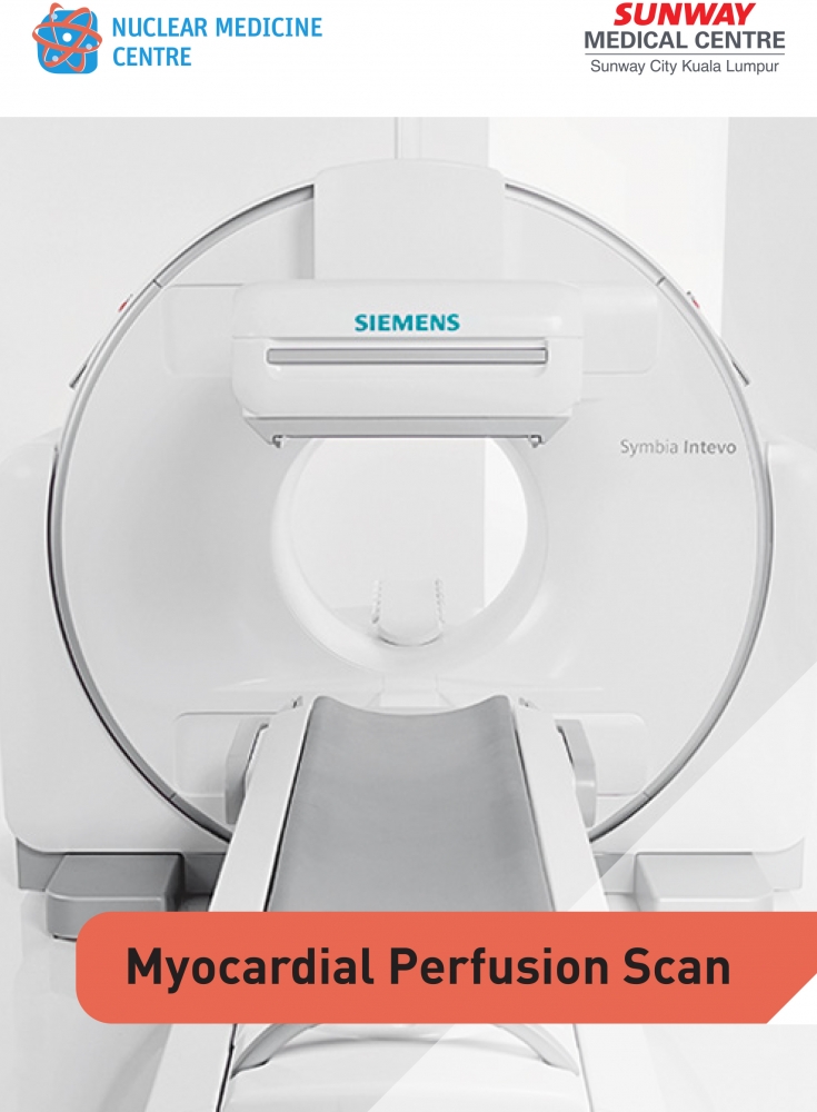 Myocardial Perfusion Scan