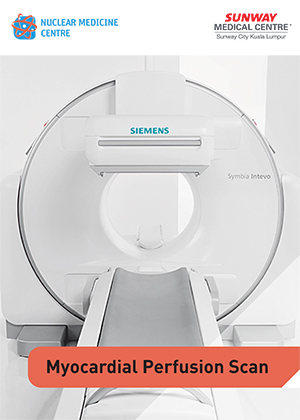 Myocardial Perfusion Scan